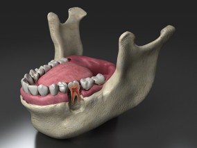 牙齿  下颌骨  牙切片  口腔  舌头  人体结构  牙床  牙神经 3d模型