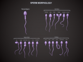 精子 精子细胞 剖面 男性精子 生殖 科普教育 VRAR 男性生殖细胞 遗传物质